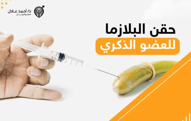 حقن البلازما للعضو الذكري