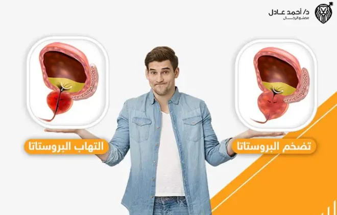 الفرق بين التهاب البروستاتا وتضخم البروستاتا