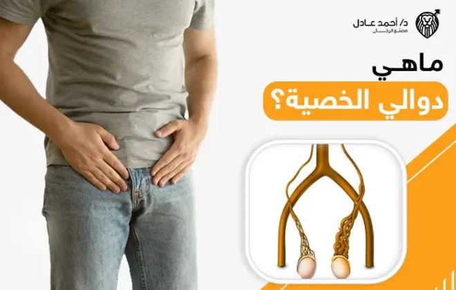 ما هي دوالي الخصية