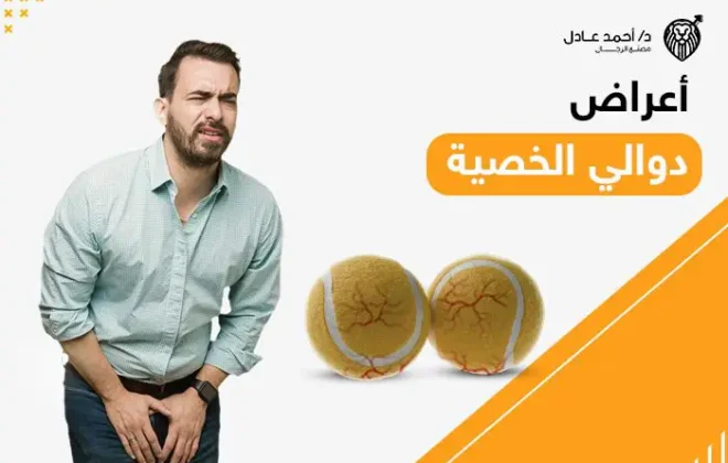 أعراض دوالي الخصية