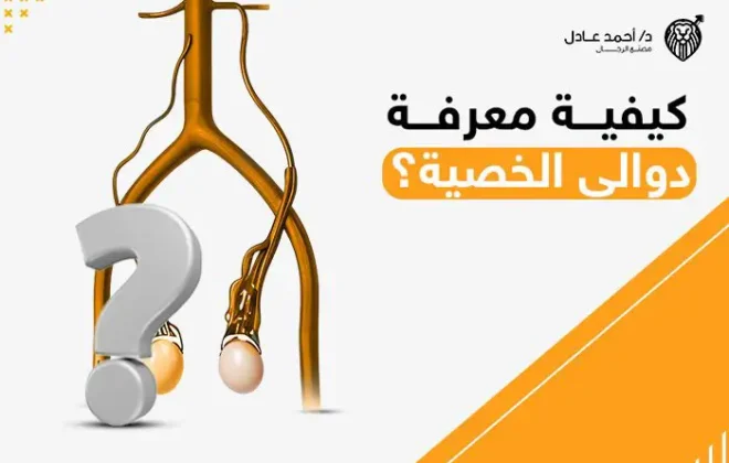 كيفية معرفة دوالي الخصية